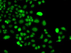 Invitrogen PIP4K2A Polyclonal Antibody 100 &mu;L; Unconjugated:Antibodies,