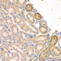 Invitrogen PIP4K2A Polyclonal Antibody 100 &mu;L; Unconjugated:Antibodies,