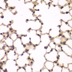 Invitrogen PIP4K2A Polyclonal Antibody 100 &mu;L; Unconjugated:Antibodies,