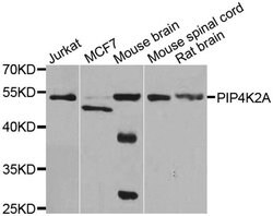 Invitrogen PIP4K2A Polyclonal Antibody 100 &mu;L; Unconjugated:Antibodies,