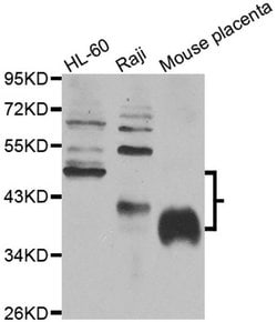 Invitrogen FCGR2B Polyclonal Antibody 100 &mu;L; Unconjugated:Antibodies,