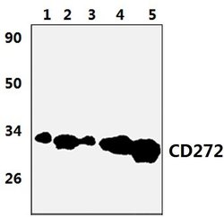Invitrogen BTLA Polyclonal Antibody 100 μL; Unconjugated:Antibodies,