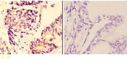Invitrogen AMPK beta-1 Polyclonal Antibody 100 &mu;L; Unconjugated:Antibodies,