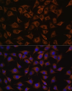 Invitrogen Prohibitin Polyclonal Antibody 100 &mu;L; Unconjugated:Antibodies,