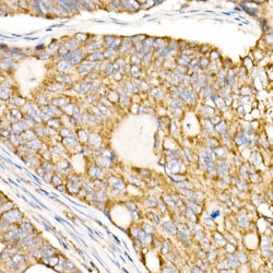 Invitrogen Prohibitin Polyclonal Antibody 100 &mu;L; Unconjugated:Antibodies,