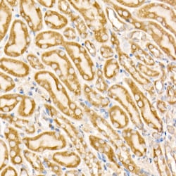 Invitrogen Prohibitin Polyclonal Antibody 100 &mu;L; Unconjugated:Antibodies,