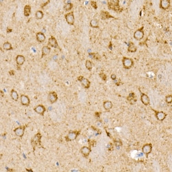 Invitrogen Prohibitin Polyclonal Antibody 100 &mu;L; Unconjugated:Antibodies,