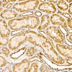 Invitrogen Prohibitin Polyclonal Antibody 100 &mu;L; Unconjugated:Antibodies,