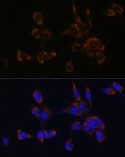 Invitrogen Perforin Polyclonal Antibody 100 &mu;L; Unconjugated:Antibodies,