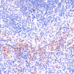 Invitrogen Perforin Polyclonal Antibody 100 &mu;L; Unconjugated:Antibodies,