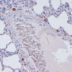 Invitrogen Perforin Polyclonal Antibody 100 &mu;L; Unconjugated:Antibodies,