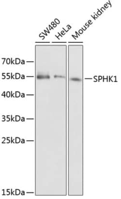 Invitrogen SPHK1 Polyclonal Antibody 100 &mu;L | Buy Online | Invitrogen&trade; | Fisher Scientific