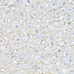 Invitrogen alpha-II Spectrin Polyclonal Antibody 100 &mu;L; Unconjugated:Antibodies,