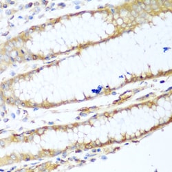 Invitrogen MYH9 Polyclonal Antibody 100 &mu;L | Buy Online | Invitrogen&trade; | Fisher Scientific