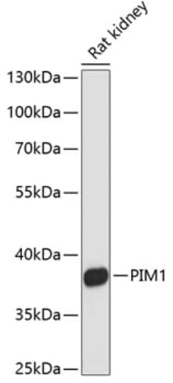 Invitrogen PIM1 Polyclonal Antibody 100 &mu;L | Buy Online | Invitrogen&trade; | Fisher Scientific