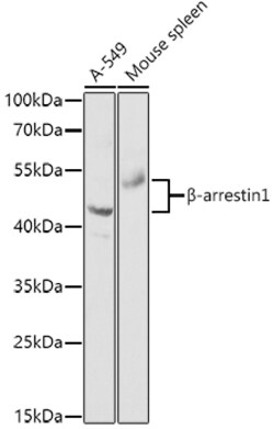 Invitrogen beta Arrestin 1 Polyclonal Antibody 100 &mu;L; Unconjugated:Antibodies,