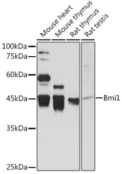 Invitrogen BMI-1 Polyclonal Antibody 100 &mu;L | Buy Online | Invitrogen&trade; | Fisher Scientific