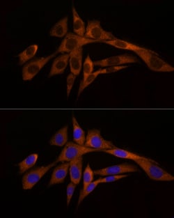 Invitrogen Caspase 8 Polyclonal Antibody 100 &mu;L; Unconjugated:Antibodies,
