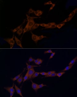 Invitrogen Caspase 8 Polyclonal Antibody 100 &mu;L; Unconjugated:Antibodies,