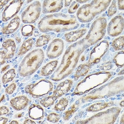 Invitrogen Caspase 8 Polyclonal Antibody 100 &mu;L; Unconjugated:Antibodies,