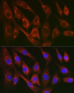 Invitrogen Cytochrome C Polyclonal Antibody 100 &mu;L; Unconjugated:Antibodies,