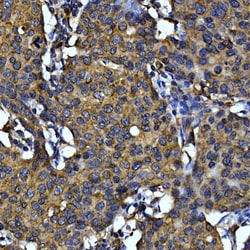 Invitrogen Cytochrome C Polyclonal Antibody 100 &mu;L; Unconjugated:Antibodies,