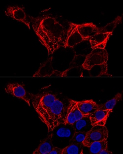 Invitrogen Cytokeratin 20 Polyclonal Antibody 100 &mu;L; Unconjugated:Antibodies,