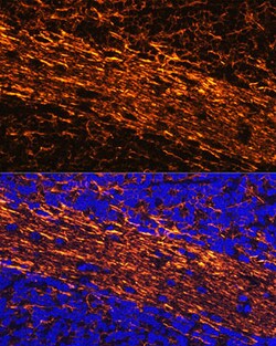 Invitrogen NEFL Polyclonal Antibody 100 &mu;L; Unconjugated:Antibodies,