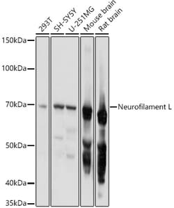 Invitrogen NEFL Polyclonal Antibody 100 &mu;L; Unconjugated:Antibodies,