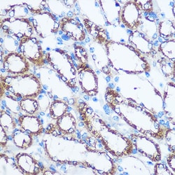 Invitrogen NME1 Polyclonal Antibody 100 &mu;L; Unconjugated:Antibodies,