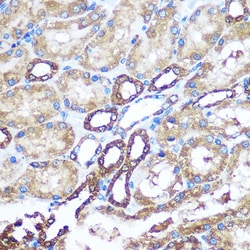 Invitrogen NME1 Polyclonal Antibody 100 &mu;L; Unconjugated:Antibodies,