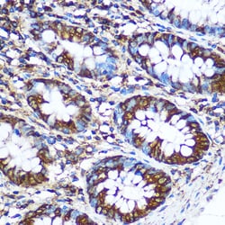 Invitrogen NME1 Polyclonal Antibody 100 &mu;L; Unconjugated:Antibodies,