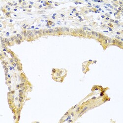 Invitrogen PKC alpha Polyclonal Antibody 100 &mu;L | Buy Online | Invitrogen&trade; | Fisher Scientific