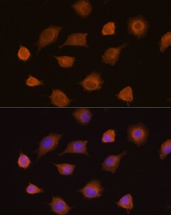 Invitrogen PKM2 Polyclonal Antibody 100 &mu;L; Unconjugated:Antibodies,