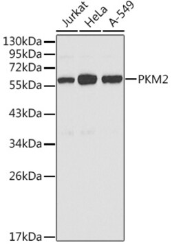Invitrogen PKM2 Polyclonal Antibody 100 &mu;L; Unconjugated:Antibodies,