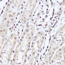 Invitrogen SOD1 Polyclonal Antibody 100 &mu;L; Unconjugated:Antibodies,