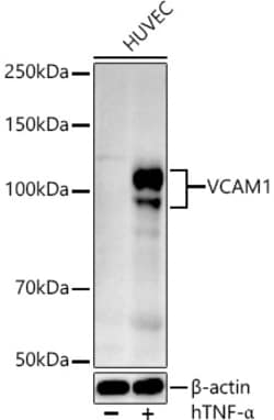 Invitrogen VCAM-1 Polyclonal Antibody 100 &mu;L; Unconjugated:Antibodies,