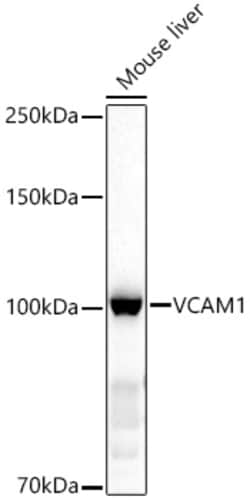 Invitrogen VCAM-1 Polyclonal Antibody 100 &mu;L; Unconjugated:Antibodies,