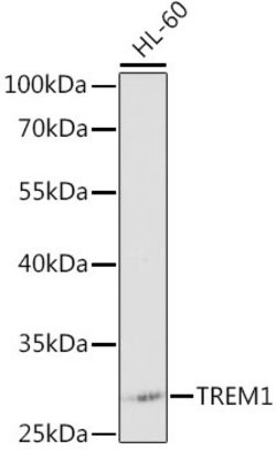 TREM-1 Polyclonal Antibody, Invitrogen 100 &mu;L; Unconjugated:Antibodies,
