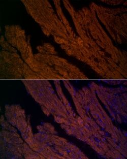 Invitrogen RyR2 Polyclonal Antibody 100 &mu;L; Unconjugated:Antibodies,