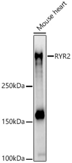 Invitrogen RyR2 Polyclonal Antibody 100 &mu;L; Unconjugated:Antibodies,