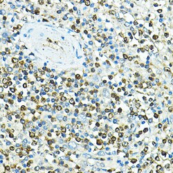 Invitrogen CD79a Polyclonal Antibody 100 μL; Unconjugated:Antibodies,