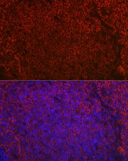 Invitrogen CD79a Polyclonal Antibody 100 μL; Unconjugated:Antibodies,