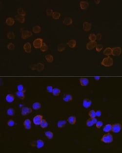 Invitrogen CD45 Polyclonal Antibody 100 &mu;L; Unconjugated:Antibodies,