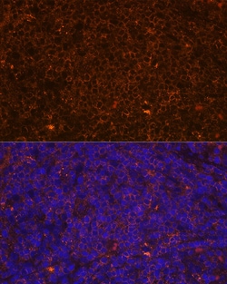 Invitrogen CD45 Polyclonal Antibody 100 &mu;L; Unconjugated:Antibodies,