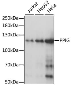 Invitrogen PPIG Polyclonal Antibody 100 &mu;L; Unconjugated:Antibodies,