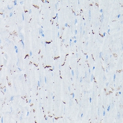 Invitrogen N-cadherin Polyclonal Antibody 100 &mu;L; Unconjugated:Antibodies,