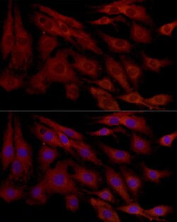 Invitrogen MCL-1 Polyclonal Antibody 100 &mu;L; Unconjugated:Antibodies,