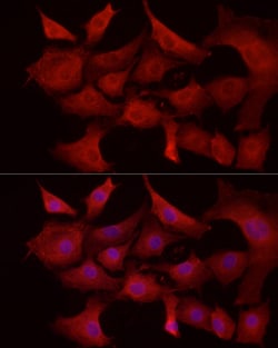 Invitrogen MCL-1 Polyclonal Antibody 100 &mu;L; Unconjugated:Antibodies,