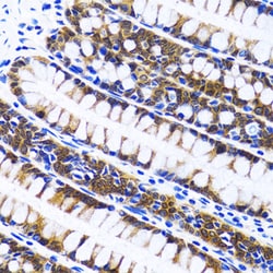 Invitrogen FASN Polyclonal Antibody 100 &mu;L; Unconjugated:Antibodies,